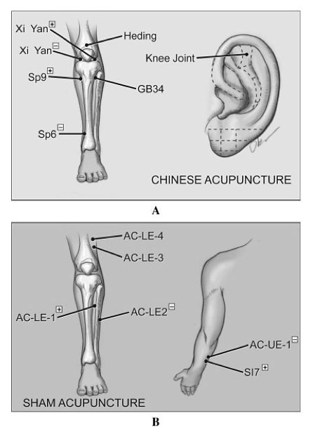 Let's needle everyone and see what happens! (Suarez-Almazor et al 2010)